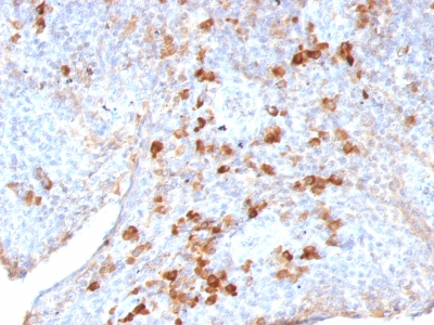 Formalin-fixed, paraffin embedded human tonsil sections stained with 100 ul anti-Lambda Light Chain (clone LAM03) at 1:100. HIER epitope retrieval prior to staining was performed in 10mM Citrate, pH 6.0.